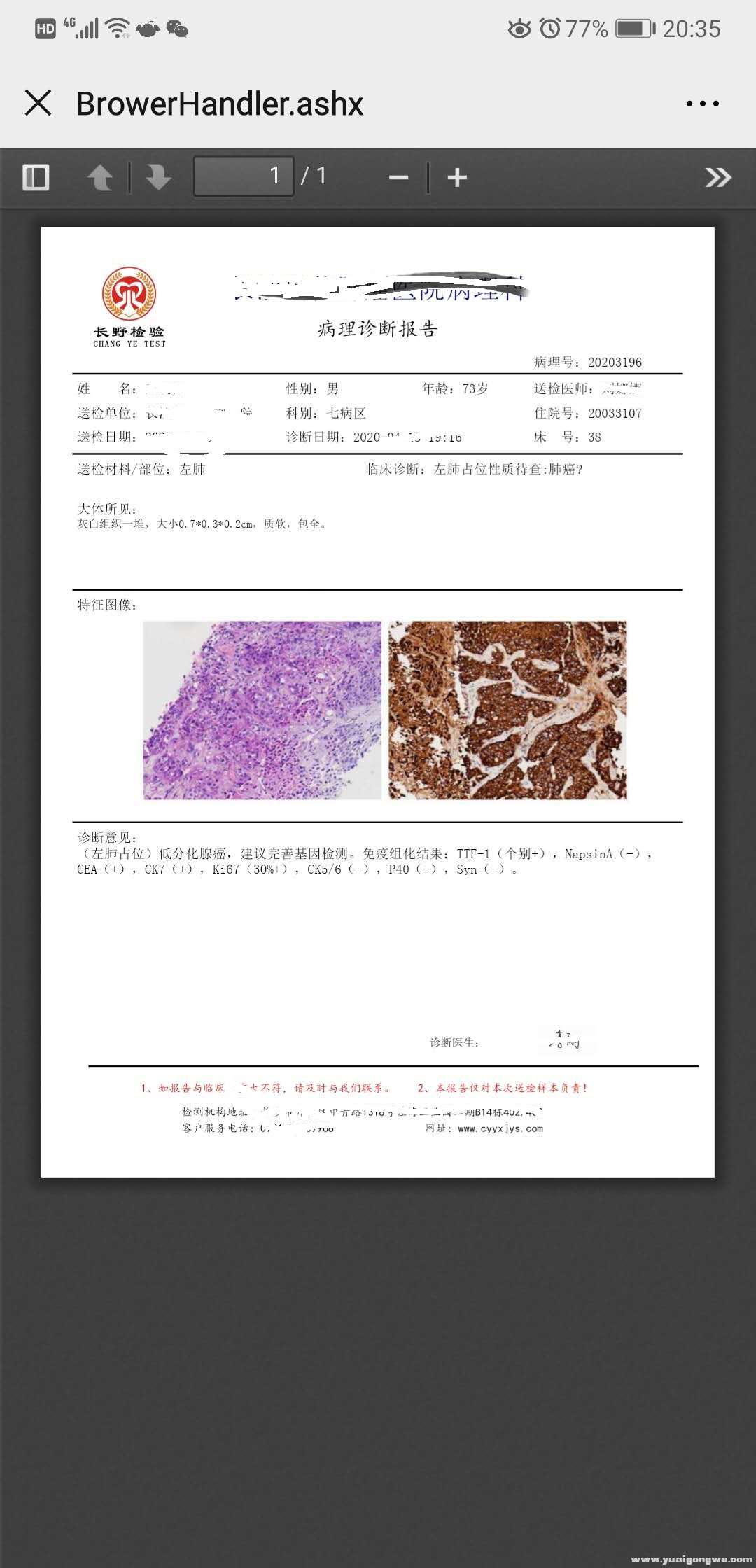 病理报告2020.jpg
