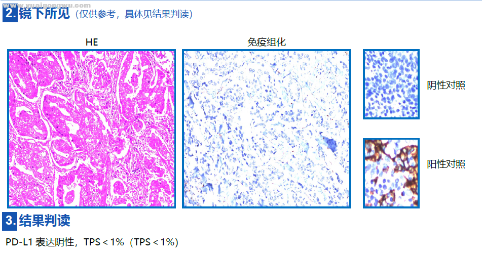 PDL1阴性